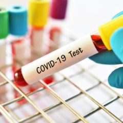 Все требования для сдачи теста на COVID-19 в США