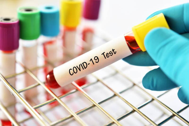 Все требования для сдачи теста на COVID-19 в США